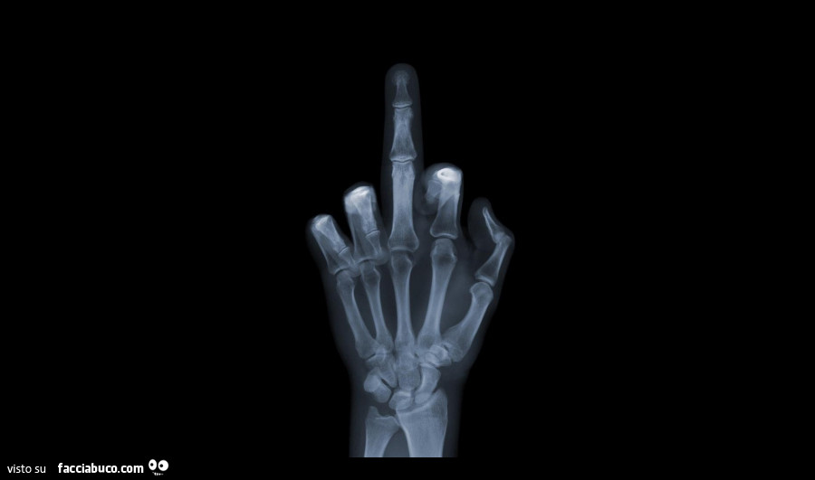 Radiografia dito medio