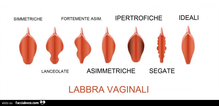 Labbra vaginali. Simmetriche, ipertrofiche, ideali, asimmetriche, segate, lanceolate