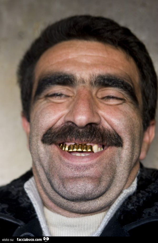 Uomo con denti d'oro